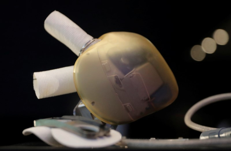 CARMAT AUTORISÉ À IMPLANTER SON COEUR ARTIFICIEL EN RÉP TCHÈQUE