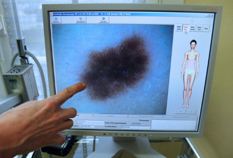 Une dermatologue explique à une patiente à l'aide d'un logiciel l'évolution d'un grain de beauté, le 4 décembre 2008 à Quimper ( AFP / FRED TANNEAU )