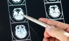 irm cerebral (Crédit:  / Rawpixel)