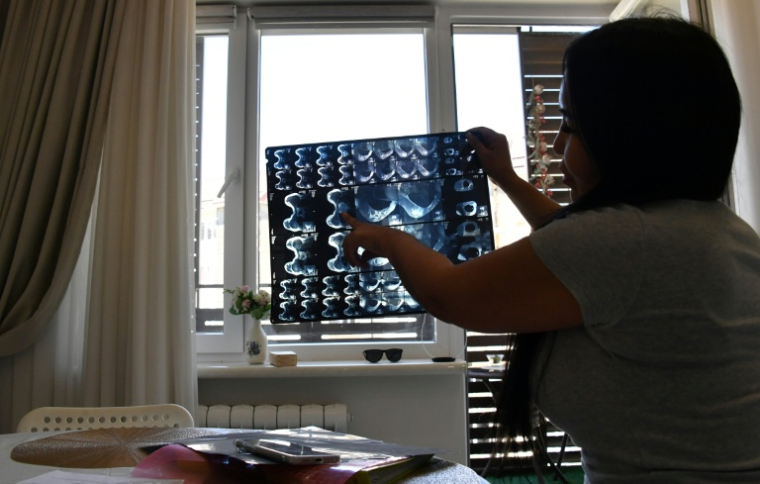 Diana Tergenbaïeva, victime d'une opération ratée de chirurgie esthétique, montre une IRM lors d'un entretien avec l'AFP à Bichkek, le 15 mai 2026 au Kirghizstan ( AFP / Vyacheslav OSELEDKO )