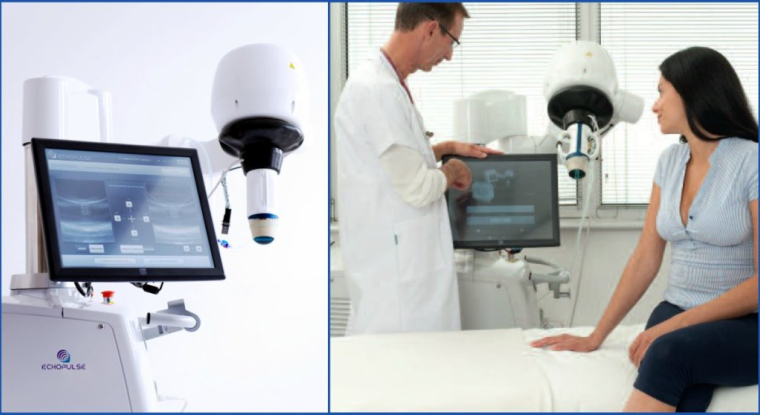 L'appareil Echopulse de Theraclion permet de traiter des tumeurs bénignes avec des ultra-sons. (© Theraclion)