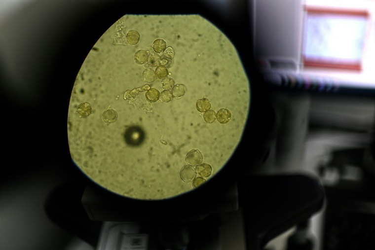 Des particules de pollen étudiées au microscope dans le laboratoire d'analyses de l'entreprise Famille Michaud Apiculteurs, le 12 juin 2025 à Gan, dans les Pyrénées-Atlantiques ( AFP / Christophe ARCHAMBAULT )