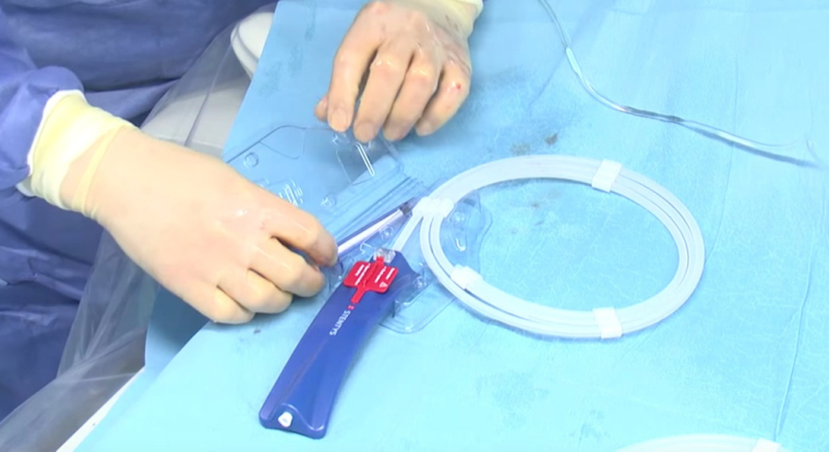 Déploiement d'un stent Stentys. (© Stentys)