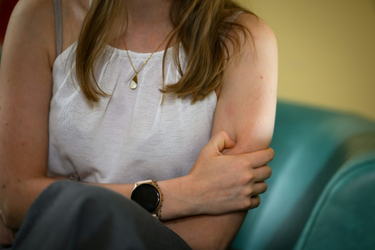 Une jeune femme souffrant de troubleS alimentaires est suivie au centre de soins Barbara du CHU de Nantes, le 20 mai 2025 ( AFP / Loic VENANCE )