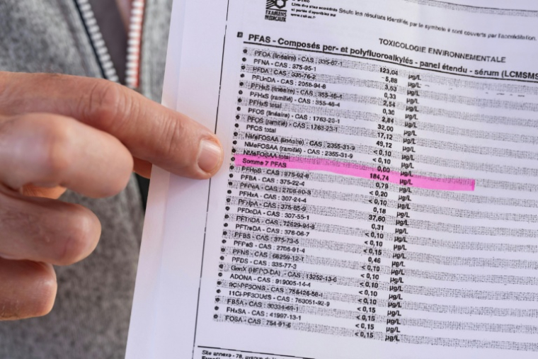Le maire de Villy (Yonne), Richard Philbiche, montre les résultats de son analyse sanguine, mettant en évidence la présence de PFAS, le 30 septembre 2025 ( AFP / Jean-Christophe VERHAEGEN )