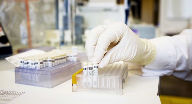 Ipsen lance une offre amicale sur la biotech américaine Albireo. (© Ipsen)