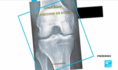 Loris Bardi : Grisant et réjouissant comme peut l'être "La Position de Schuss"