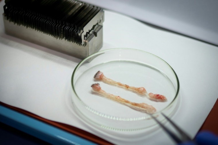 Deux biopsies de tissu adipeux prélevées sur un ours polaire, dans un laboratoire du navire brise-glace scientifique Kronprins Haakon», dans l'archipel du Svalbard, le 9 avril 2025 ( AFP / Olivier MORIN )