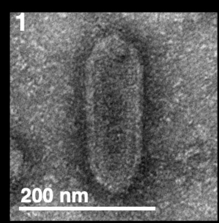 Image non datée, diffusée par Cell Press le 6 mars 2026, montrant un virus de la stomatite vésiculaire (VSV) normal, sans deltavirus ( Cell Press / Handout )