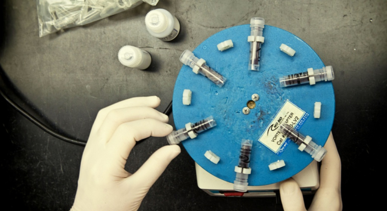 L'action Abivax a ouvert en forte hausse ce lundi avant de progressivement s'approcher de l'équilibre. (© DR)