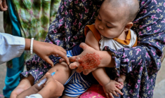 Campagne de vaccination contre la rougeole, à Dacca, le 12 avril 2026 ( AFP / Munir UZ ZAMAN )