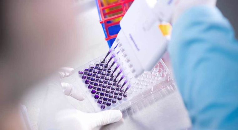 La biotech Valneva a dévoilé un chiffre d'affaires au premier trimestre à 32,1 millions d'euros, en hausse de 13%. (© Valneva)