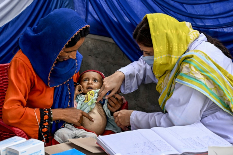 Une médecin (d) examine un enfant lors d'un programme de nutrition de l'Unicef au village de Fateh Muhammad Soomro, dans la province du Sindh, le 29 juillet 2025 au Pakistan ( AFP / Rizwan TABASSUM )