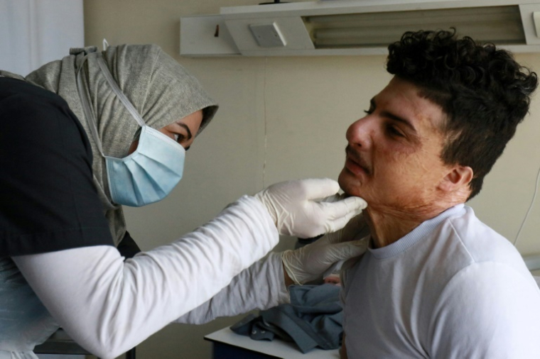 Le patient Houssam Abderrahmane, brûlé lors d'une explosion en Irak, reçoit des soins à l'hôpital Al-Mouwasat, géré par Médecins sans frontières (MSF) à Amman, le 15 avril 2025 en Jordanie ( AFP / Khalil MAZRAAWI )