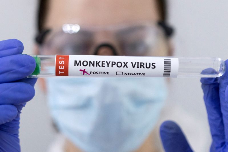 FRANCE-PLUS DE 2.600 CAS DE VARIOLE DU SINGE, PLUS DE 30.000 VACCINÉS, SELON FRANÇOIS BRAUN