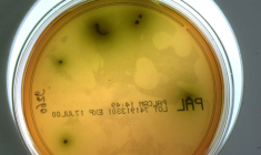 Gros plan d'une souche de listeria pris le 10 mai 2000 au laboratoire d'analyse départementale de la Manche à St Lo ( AFP / MYCHELE DANIAU )