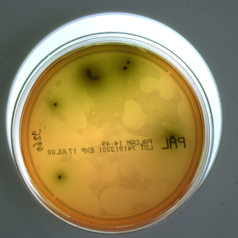 Gros plan d'une souche de listeria pris le 10 mai 2000 au laboratoire d'analyse départementale de la Manche à St Lo ( AFP / MYCHELE DANIAU )