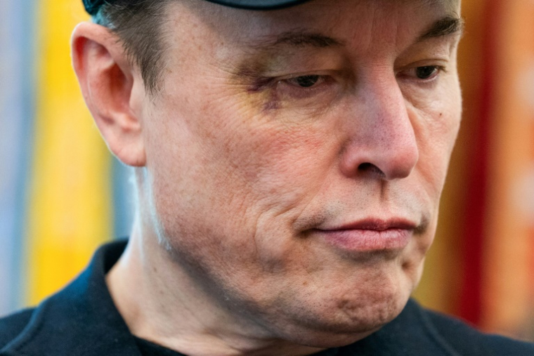 L'homme d'affaires et ex-conseiller du président américain Donald Trump, Elon Musk, avec un oeil au beurre noir lors d'une conférence de presse à la Maison Blanche, à Washington, aux Etats-Unis, le 30 mai 2025 ( AFP / Allison ROBBERT )