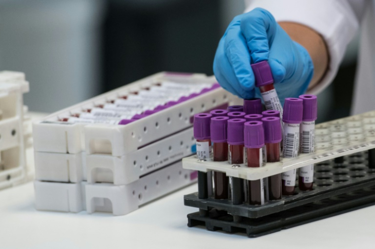 Cette technologie, également appelée de l'ADN tumoral circulant, consiste à suivre l'évolution d'un cancer par une simple prise de sang - et non par biopsie classique ( AFP / SEBASTIEN BOZON )