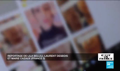 Chirurgie esthétique : l'approche française au scalpel