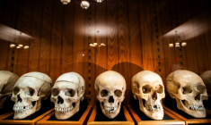 La collection de crânes d'un anatomiste autrichien au Mütter Museum de Philadelphie, le 20 août 2025 en Pennsylvanie ( AFP / Matthew Hatcher )