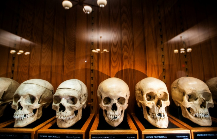 La collection de crânes d'un anatomiste autrichien au Mütter Museum de Philadelphie, le 20 août 2025 en Pennsylvanie ( AFP / Matthew Hatcher )