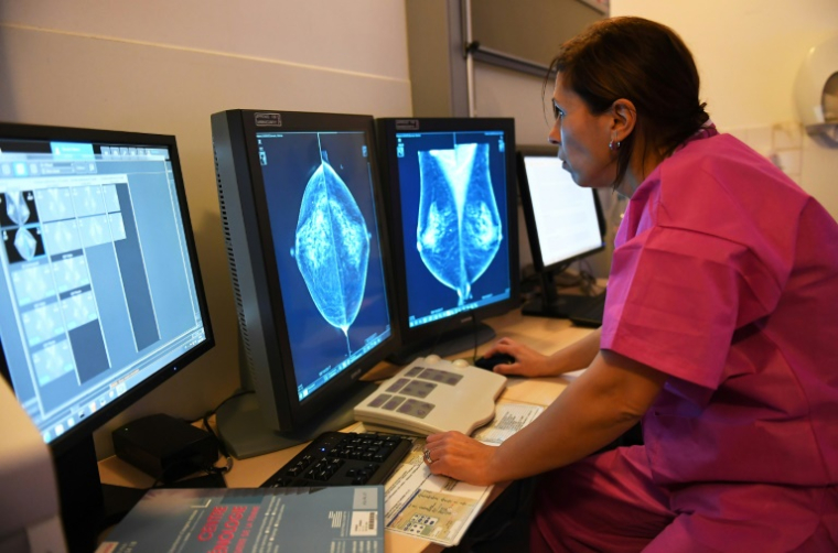 Une médecin consulte les résultats d'une mammographie, le 9 octobre 2017 à Marseille ( AFP / ANNE-CHRISTINE POUJOULAT )