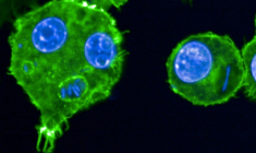 Des macrophages infectés par la bactérie Yersinia pestis photographiés en 2024 sur un cliché publié par l'Institut Pasteur, à Paris le 27 mai 2025 ( Institut Pasteur / Anne DERBISE )