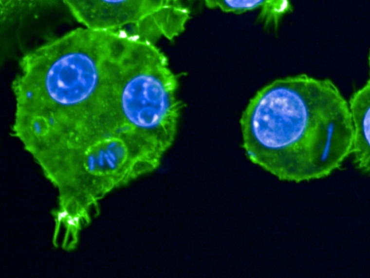 Des macrophages infectés par la bactérie Yersinia pestis photographiés en 2024 sur un cliché publié par l'Institut Pasteur, à Paris le 27 mai 2025 ( Institut Pasteur / Anne DERBISE )