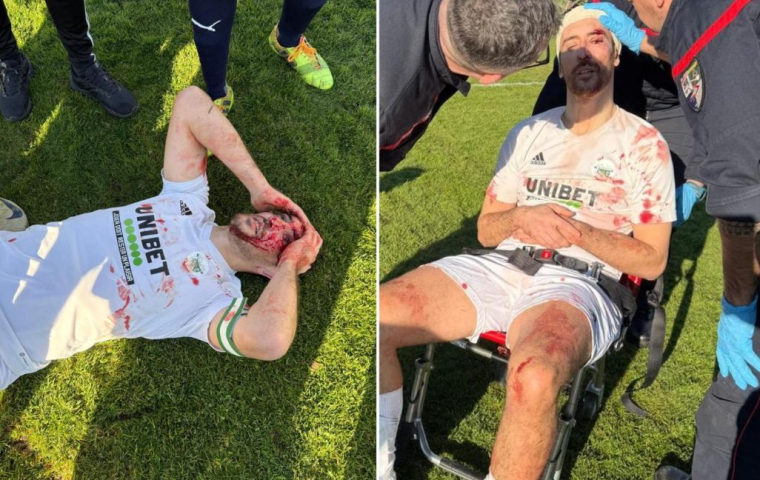 Blessure à l’œil, clés à molette : ce match amateur en Gironde déborde complètement