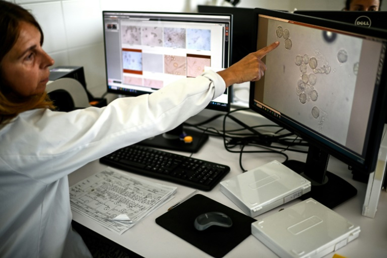 Une technicienne montre des particules de pollen au microscope dans le laboratoire d'analyses de l'entreprise Famille Michaud Apiculteurs, le 12 juin 2025 à Gan, dans les Pyrénées-Atlantiques ( AFP / Christophe ARCHAMBAULT )