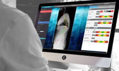 La medtech a levé 9 millions d'euros lors de son introduction en Bourse. (© SMAIO)