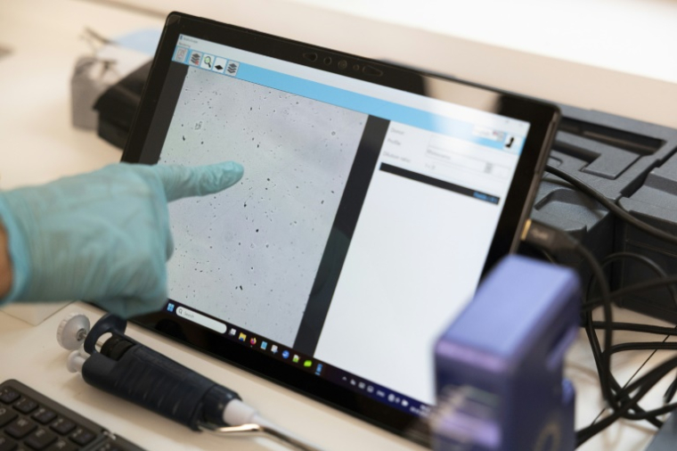 Les spermatozoïdes de la panthère mâle Baruto vus au microscope, lors du prélèvement de semence, le 9 octobre 2025 au zoo de Mulhouse, dans le Haut-Rhin ( AFP / ROMEO BOETZLE )