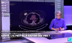 Irène Buvat : «L’algorithme ne doit pas devenir une source d’appauvrissement du savoir des médecins»