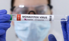 FRANCE-PLUS DE 2.600 CAS DE VARIOLE DU SINGE, PLUS DE 30.000 VACCINÉS, SELON FRANÇOIS BRAUN