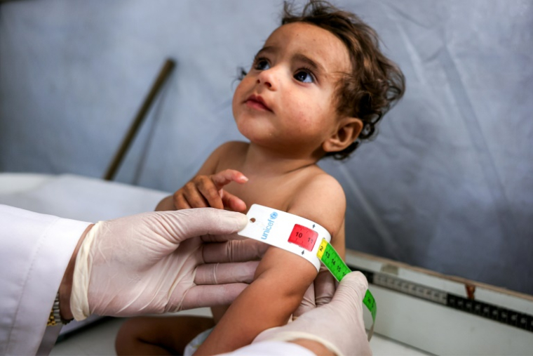 Nujud Suleiman, une fillette de un an souffrant de malnutrition prise en charge à l'hôpital Kamal Adwan de Beit Lahia, dans le nord de la bande de Gaza, le 24 avril 2025 ( AFP / Bashar TALEB )