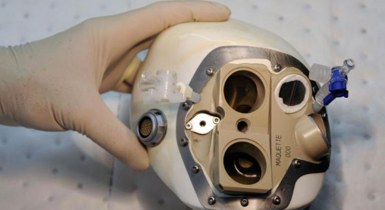 Un coeur artificiel fabriqué par la société Carmat. (© F. Fife / AFP)