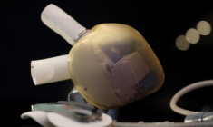 CARMAT: IMPLANTATION D'UN COEUR ARTIFICIEL EN RÉPUBLIQUE TCHČQUE