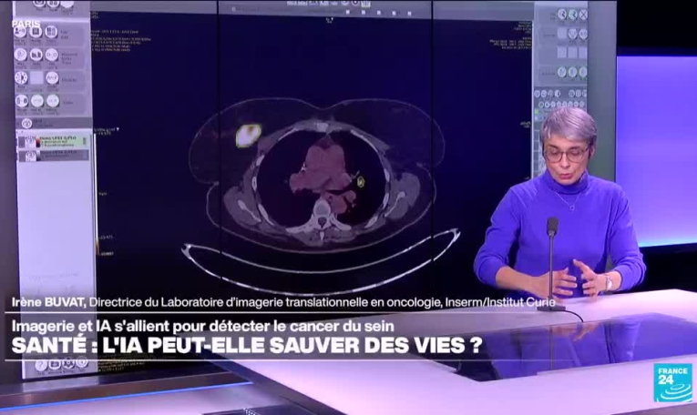 Irène Buvat : «L’algorithme ne doit pas devenir une source d’appauvrissement du savoir des médecins»