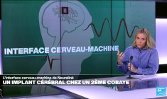 Neuralink : un implant cérébral bientôt chez un second cobaye