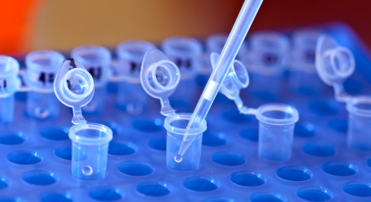 OSE développe des médicaments innovants contre le cancer. Son projet le plus avancé s’appelle Tedopi. (© University of Michigan)