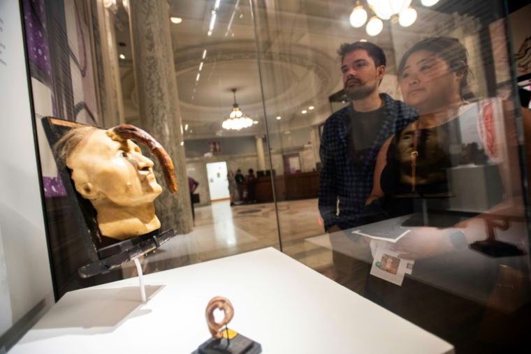 Des visiteurs observent le moulage en cire d'une tête de femme ayant une ex-croissance sur le front au Mütter Museum de Philadelphie, le 20 août 2025 en Pennsylvanie ( AFP / Matthew Hatcher )
