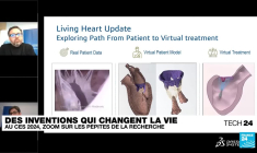 Marcher par la pensée et accompagner les aveugles : ces prouesses qui peuvent changer la vie