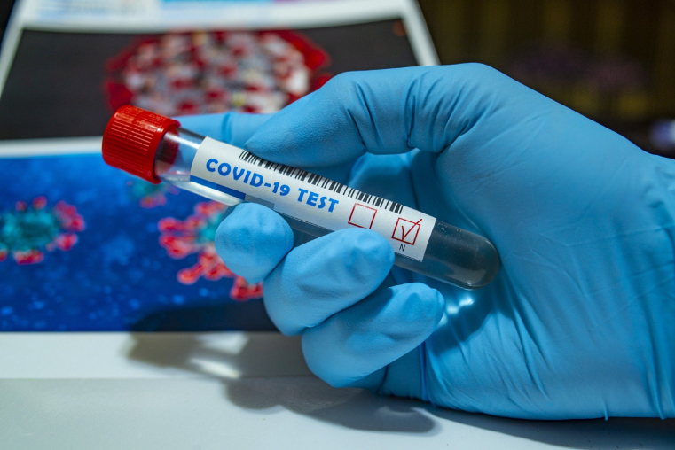 Le salarié avait été licencié après avoir été testé positif au coronavirus. Illustration (Pixabay / fernandozhiminaicela)