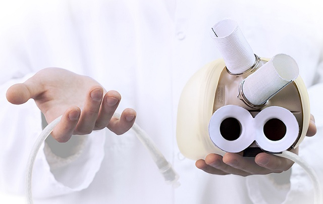 La prothèse de coeur intégrale Carmat. (crédits : Carmat)