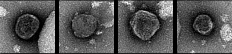 Images non datées, obtenues par microscopie électronique à coloration négative et publiées par Cell Press le 6 mars 2026, montrant un reptarénavirus de serpent associé à un deltavirus de serpent ( Cell Press / Handout )