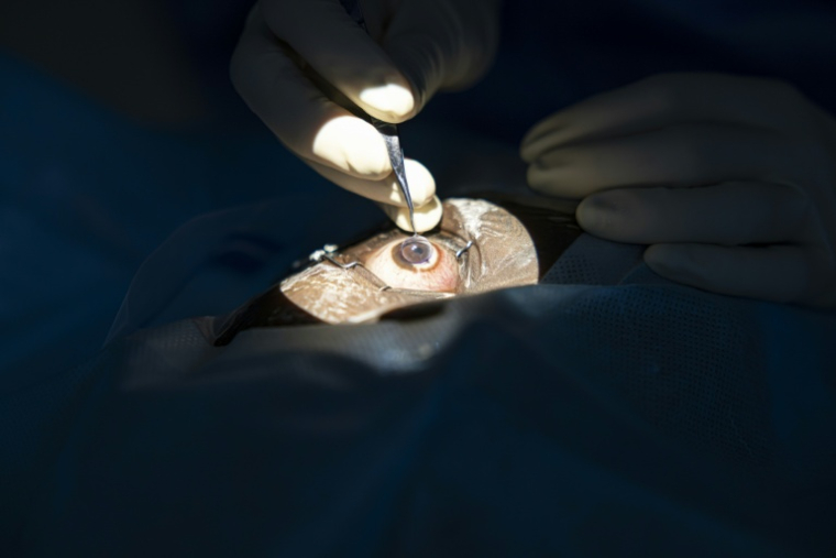 Une greffe de cornée pratiquée à l'hôpital d'ophtalmologie Lions SightFirst à Nairobi le 12 août 2023  ( AFP / Patrick Meinhardt )