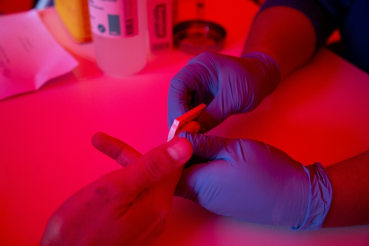 La précarité, un moteur de l'épidémie de VIH en Guyane  ( AFP / CLAUDIO REYES )