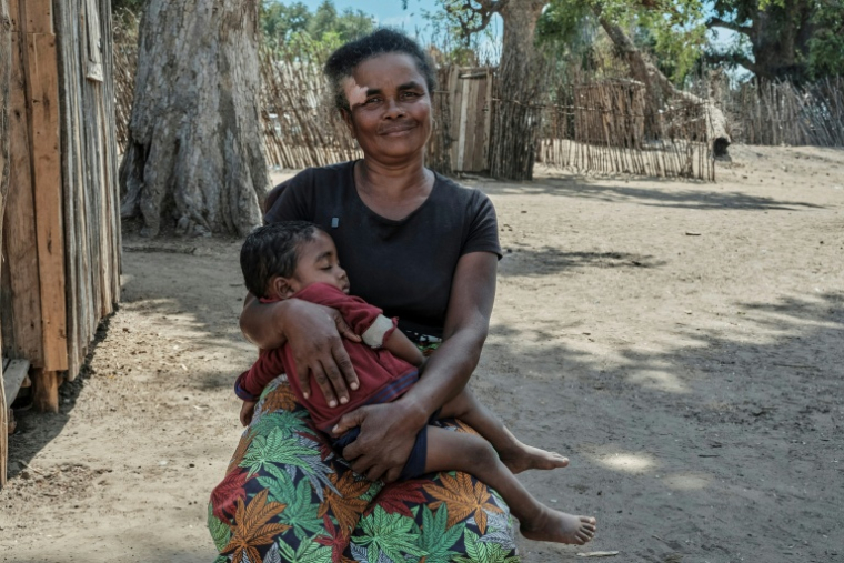 Eva Razafindrazaka avec sa petite-fille de quatre ans souffrant de malnutrition, lors d'un bilan de santé au Farne à Ifotaka, le 24 septembre 2026 ( AFP / Razafindrakoto Mamy Nirina )