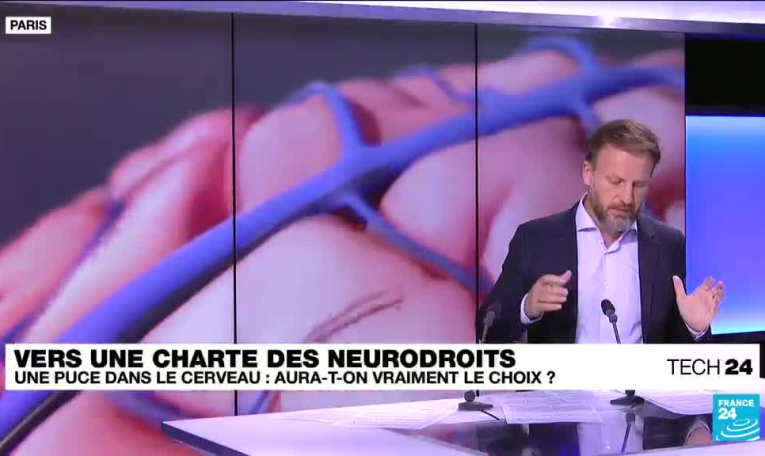 Puce dans le cerveau : et si un jour, nous n'avions plus le choix ? De l'utilité des "neurodroits" !